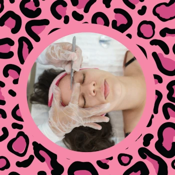 DERMAPLANING